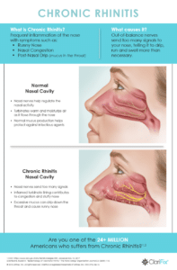 runny rhinitis